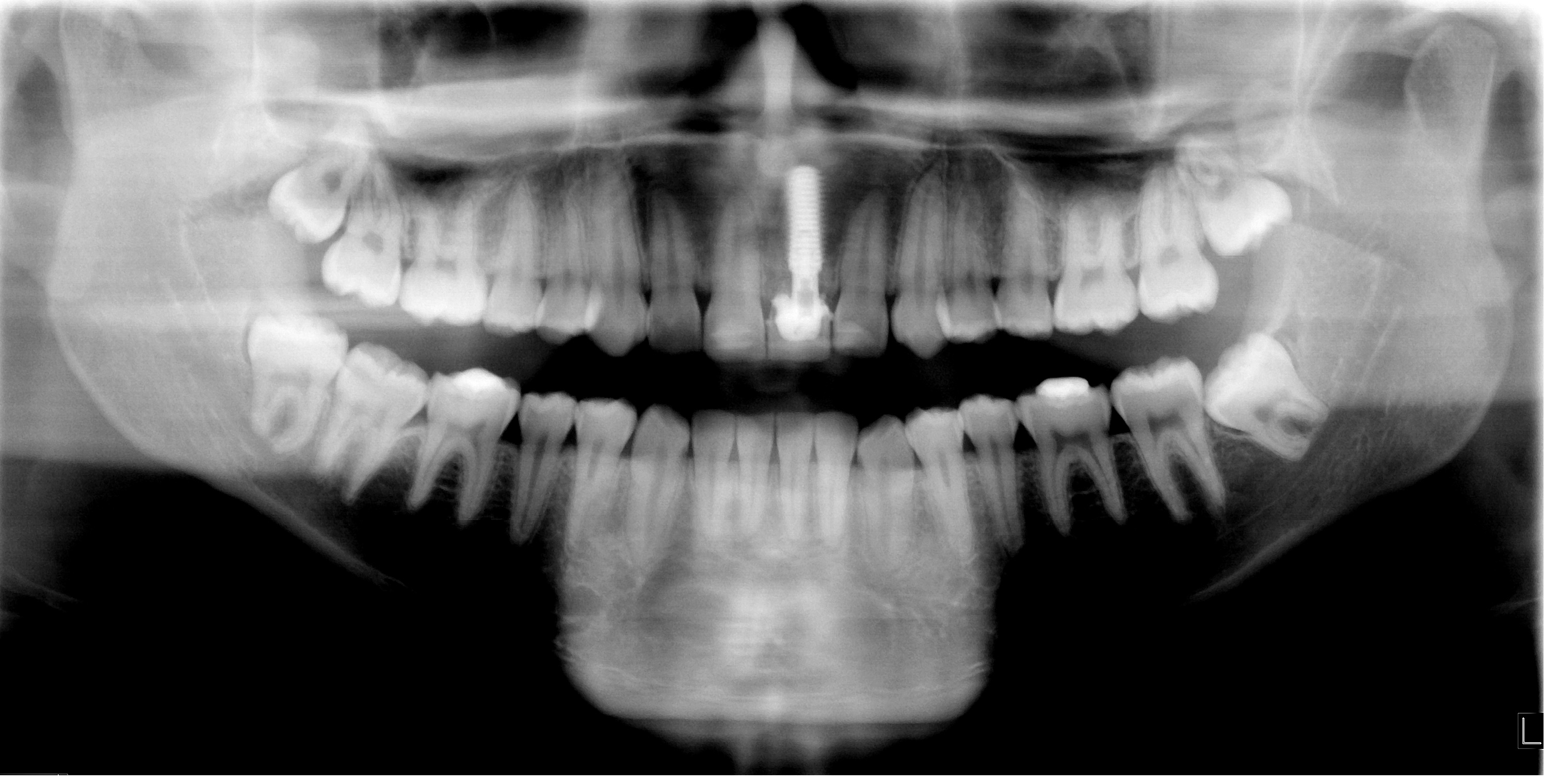 Restaurando o sorriso e a esperança de um jovem