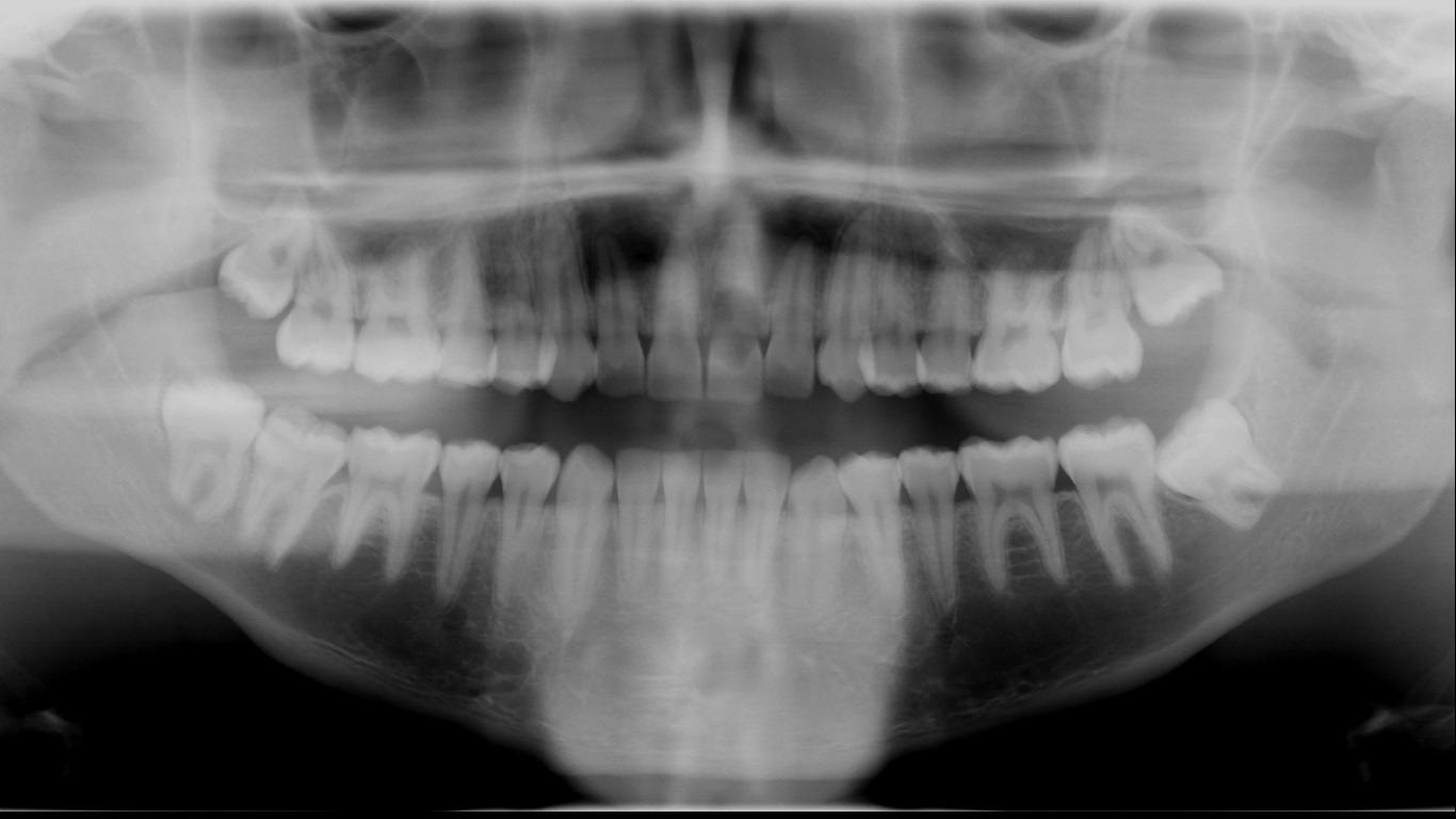 Restaurando o sorriso e a esperança de um jovem