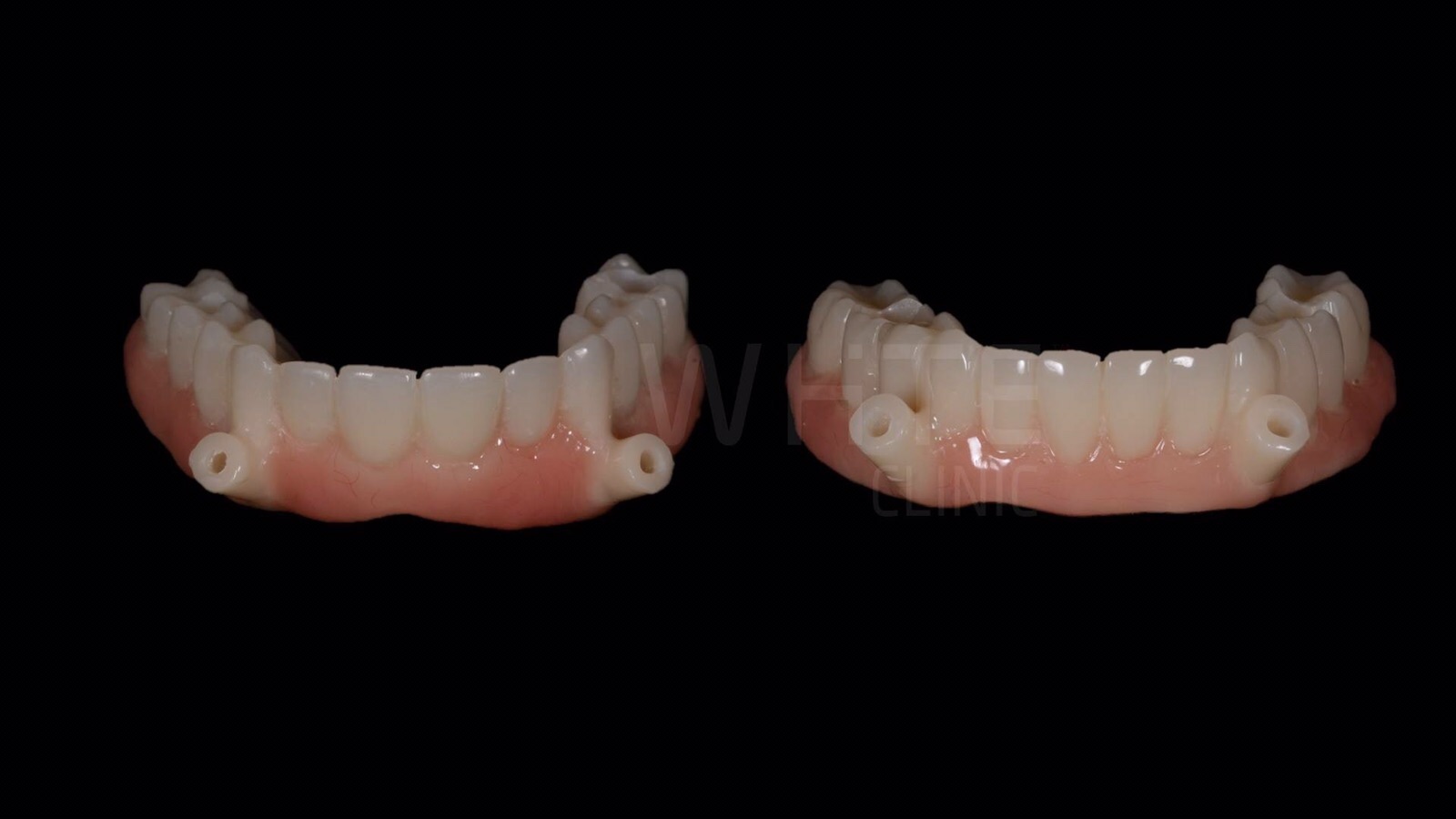 Um Sorriso Imediato | Instant Smile